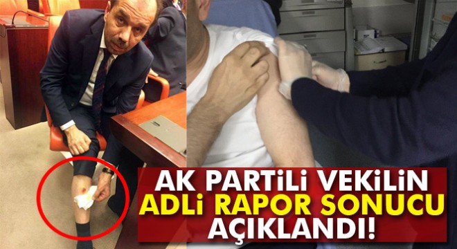 Adli Tıp  AK Parti Trabzon Milletvekili ısırıldı  dedi