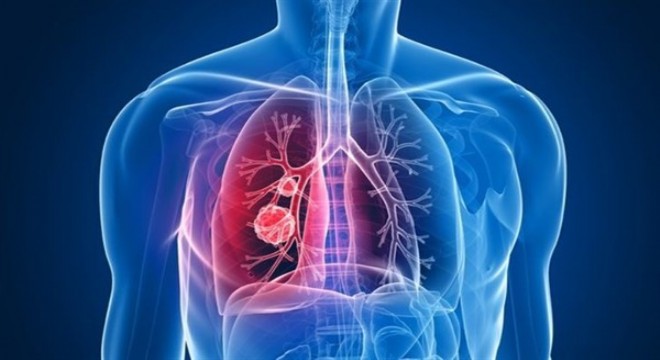 COVID-19 hastaları 15 adımda akciğer sağlığını koruyabilir